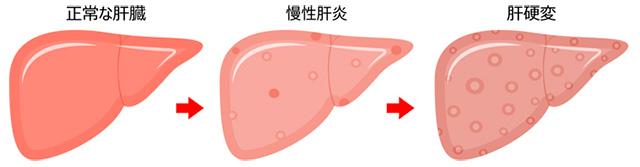 肝臓内科について