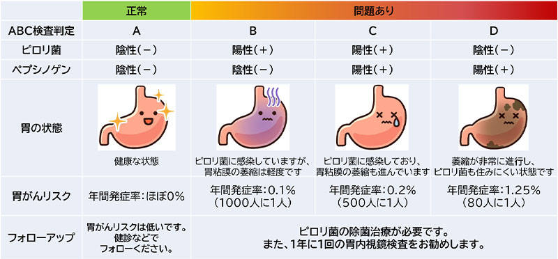 ABC検診